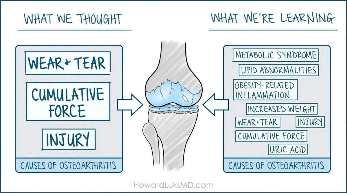 Osteoarthritis, Joint Health and Metabolic Wellbeing: A Whole-Body Approach infographic illustrating causes of osteoarthritis.